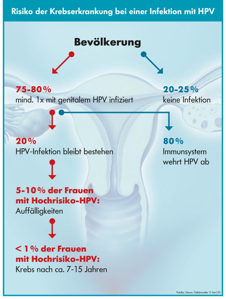 Kann Man Sich Mit Gürtelrose Anstecken HPV-Infektion & Risiko Krebserkrankung - Movare Heilpraxis