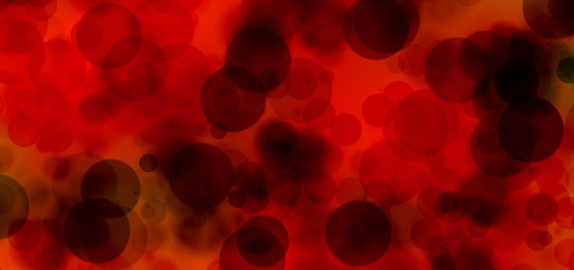 Long COVID - veränderte Blutzellen